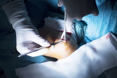 Cropped hands of doctor performing operation on patient knee in hospital