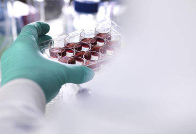 Cropped hand of scientist wearing protective glove holding multiwell tray containing stem cells during research in laboratory