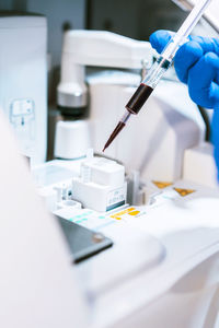 Hand of doctor analyzing blood sample at laboratory