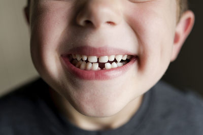 Close-up of boy showing gap toothed