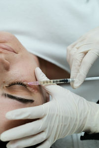 Closeup view of eye mesotherapy procedure on woman face