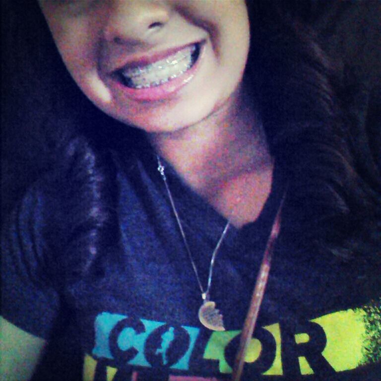 I dislike my smile (/.\)