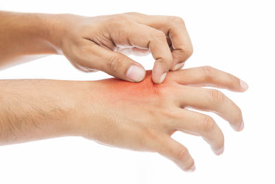 Cropped image of person scratching hand against white background