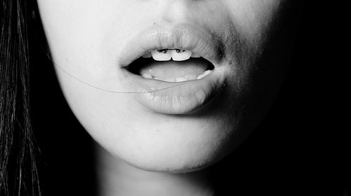 Close-up of woman wearing braces with mouth open