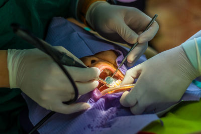 Midsection of male dentist operating patient in hospital