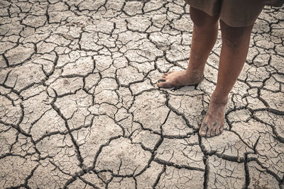 The little boy waiting for drinking water to live through this drought,