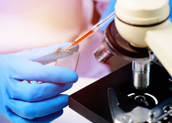 Close-up of medical professional holding chemical on microscopic slide