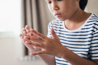 Fresh wound and blood from injured on child fingers after she has been an accident.