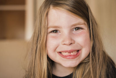 Closeup of a young girls mouth with missing teeth