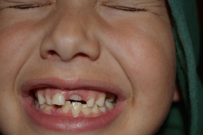 Close-up of boy with gap toothed