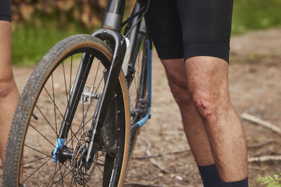 Male cyclist with scratched knee