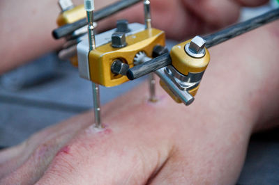 Cropped image of surgeon operating hand on table