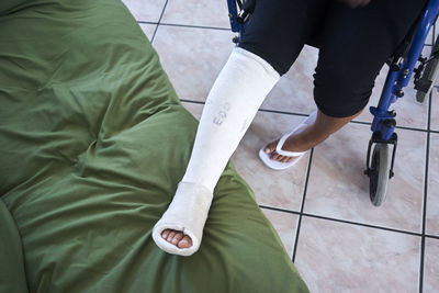 Closeup of a leg with plaster