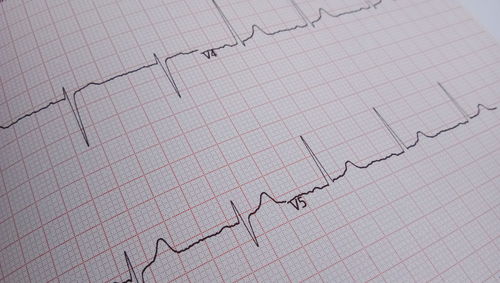 Close-up of pulse trace paper