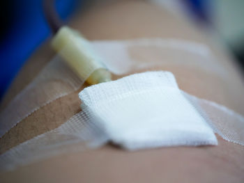 Close-up of iv drip on hand