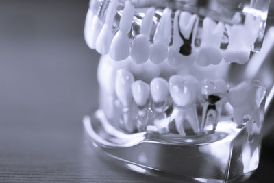 Close-up of dentures on table