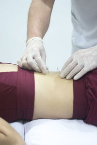 Midsection of message therapist inserting needles on woman back