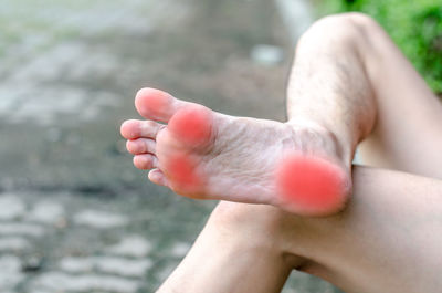 Low section of man with foot pain sitting outdoors