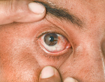 Close-up of human eye