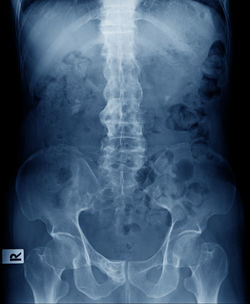 Full frame shot of x-ray