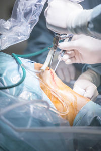 Cropped hands of surgeons operating patient at hospital