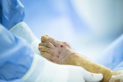 Cropped image of doctor operating patient in hospital