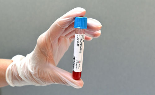 Coronavirus test blood sample positive result on white background.