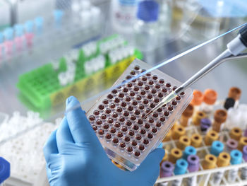 Scientist pipetting blood sample in microplate at laboratory