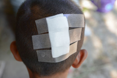 Rear view of man with bandage on head