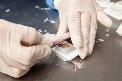 Scientist preparing paraffin blocks containing biopsy tissue for sectioning. pathology laboratory. 