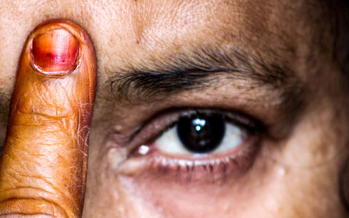 Close-up portrait of man touching head