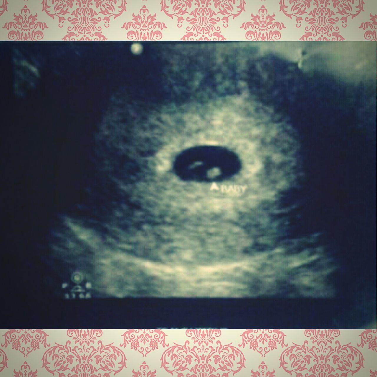 Im gonna be a aunt!