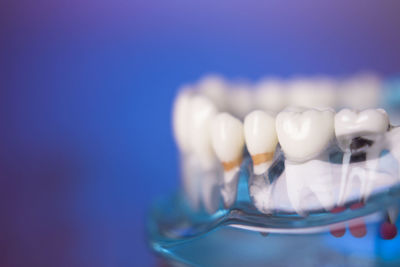 Close-up of dentures against blue background