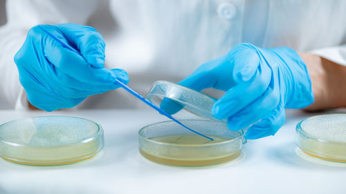 Microbiology researcher working in a laboratory, using an inoculation rod to spread out culture 