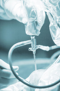 Close-up of medical equipment in wounded knee in operating room