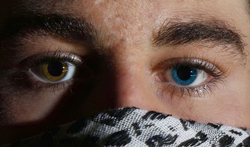 Close-up portrait of man with differently colored eyes