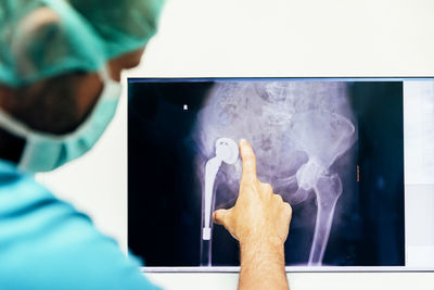 Midsection of doctor examining medical x-ray over computer