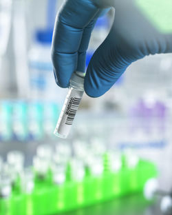 Scientist preparing dna samples for testing in the lab.