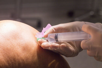 Close-up of doctor injecting patient on knee