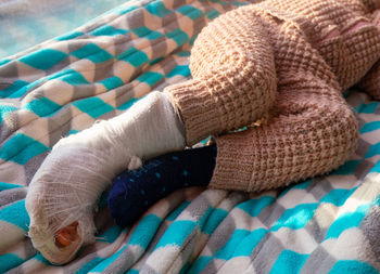 Child with bandage on leg heel fracture. broken right foot, splint of toddler. 