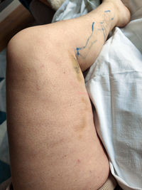 arm