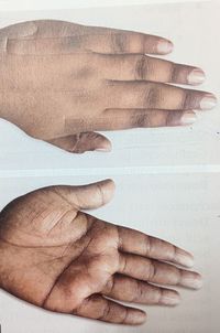finger