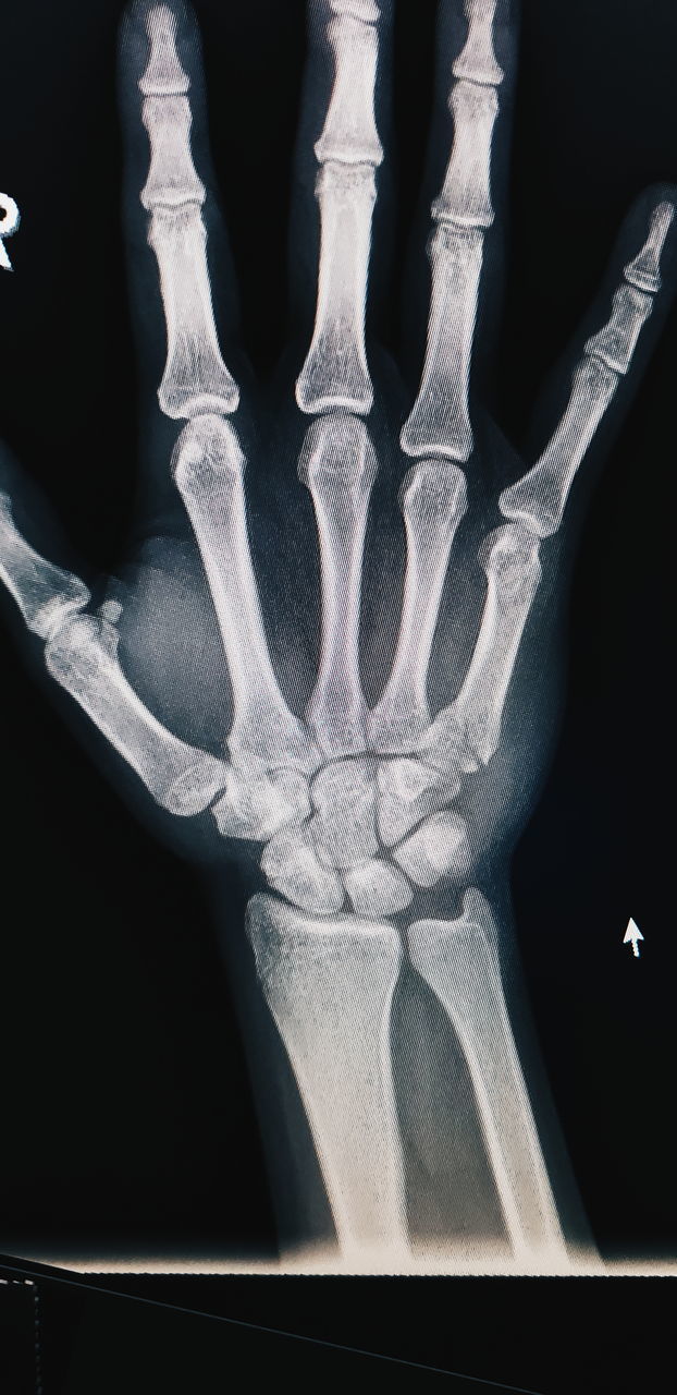 CLOSE-UP OF HUMAN HAND ON BLACK AND WHITE