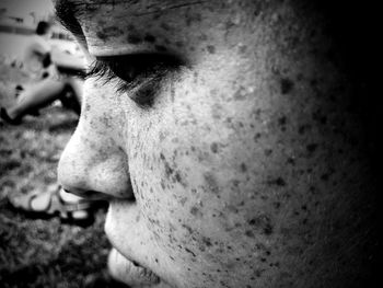 Close-up of man with freckles