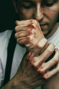 Close-up of man with injury on fist