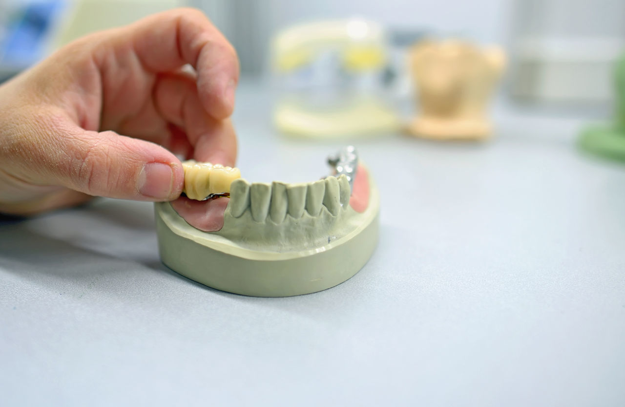 Prosthodontic; ceramic; partial; occlusion; production; professional; dent; dentistry; working; mandibular; instrument; compound; health; bridge; job; detail; maxilla; hand; corona