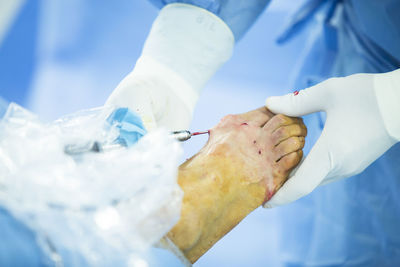 Cropped image of doctor removing medical equipment from patient foot in hospital