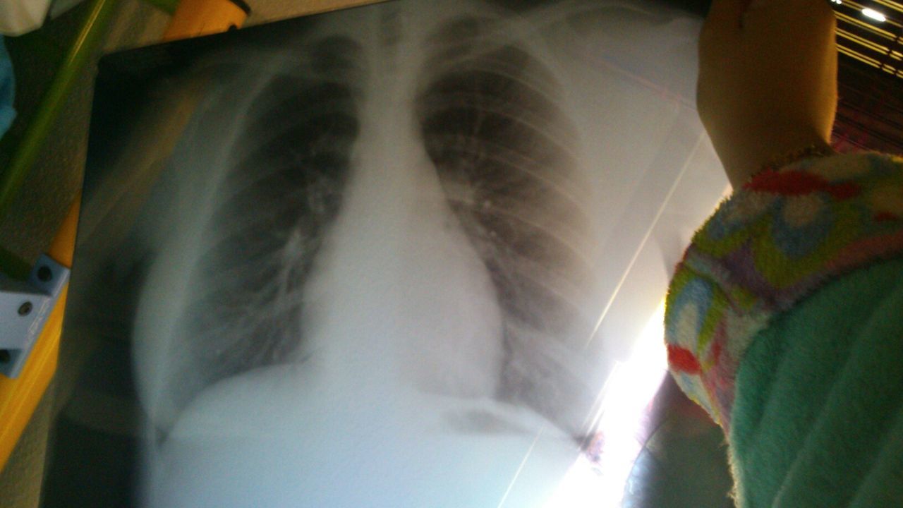 Radiografia