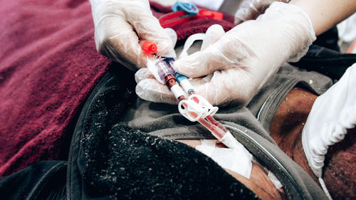 Cropped hand of nurse treating patient in hospital