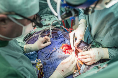 Surgeons executing heart bypass surgery